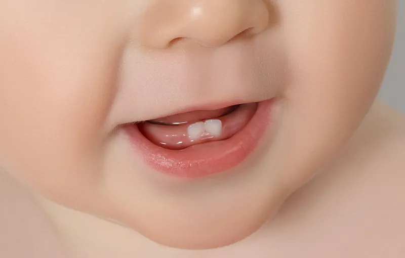 Nicanje mlečnih i stalnih zuba
