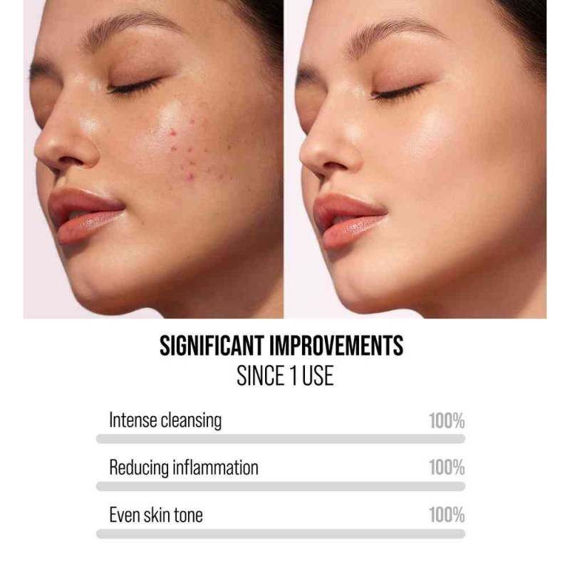 7DAYS GLINENA MASKA 2U1 