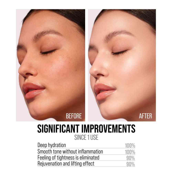 7DAYS SERUM LICE SQUALANE 