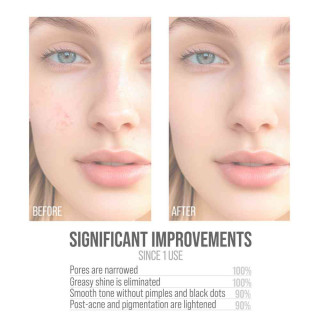 7DAYS SERUM KONTROLA SEBUMA B3 ZN 