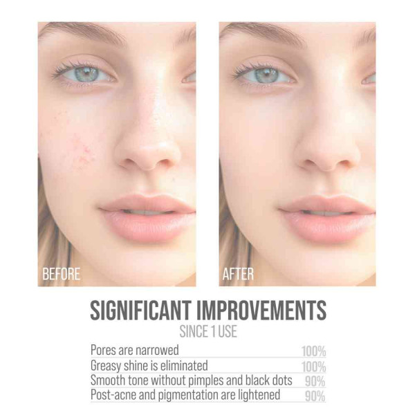 7DAYS SERUM KONTROLA SEBUMA B3 ZN 