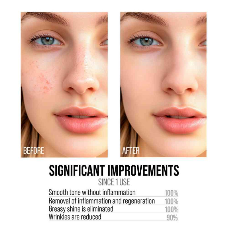 7DAYS SERUM PILING AHA BHA 